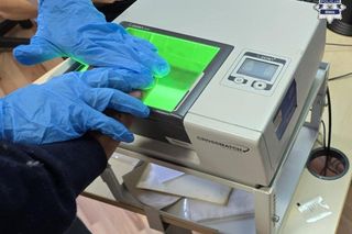 Horror w parku w Knurowie. Poszło o pieniądze. 69-latek zranił kolegę i uciekł