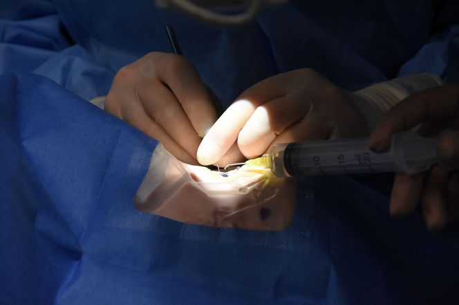 Przełomowa metoda leczenia zaćmy u dzieci w Katowicach. Uratowali wzrok 3,5-letniej Marysi