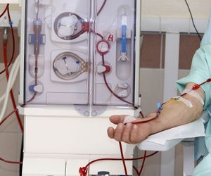 Sztuczna nerka (dializator): jak działa? Rodzaje dializatorów