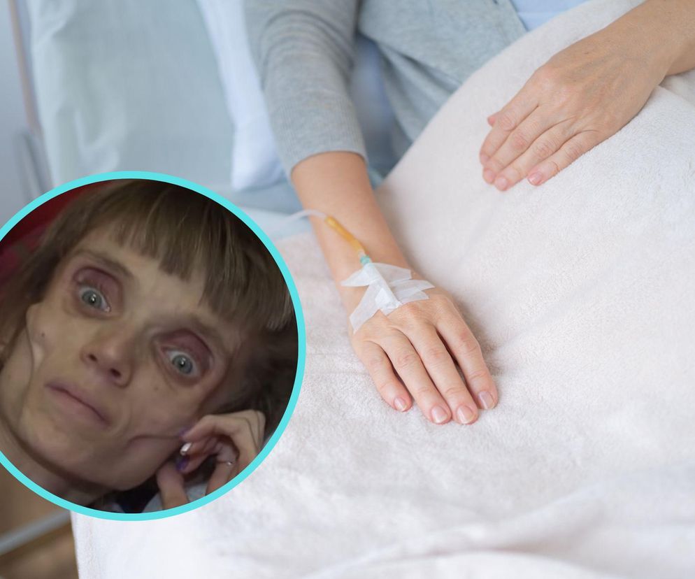 Jej waga sięgała 17 kg w krytycznym momencie. Tutaj samo ciało stawia opór