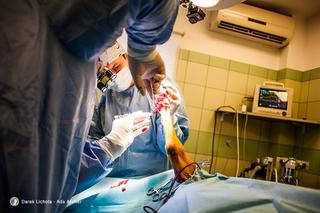 Dostał łapę z drukarki 3d