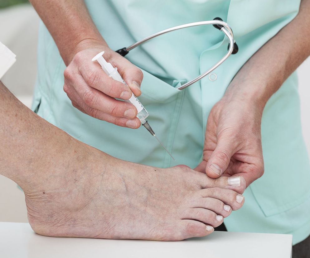 Grzybica, kurzajki, halluksy a ciąża - musisz na nie wyjątkowo uważać