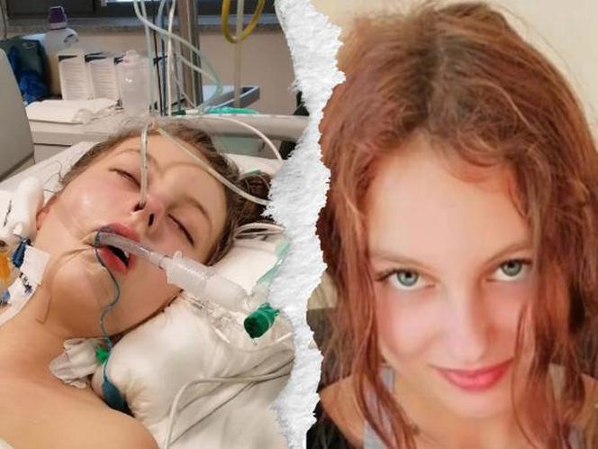 Tragiczne skutki COVID-19. 14-letnia Amelka walczy o życie. Pilny apel