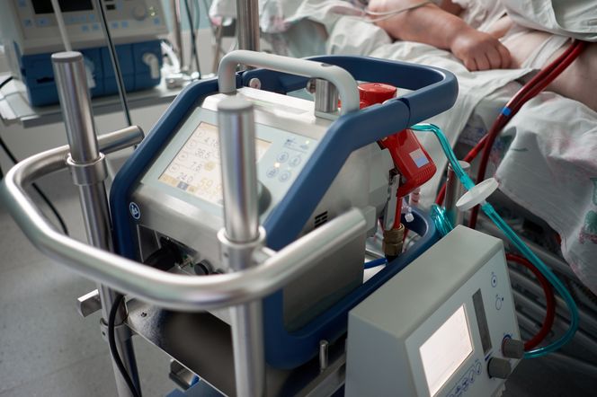 ECMO - co to jest? Wskazania i zastosowanie w medycynie