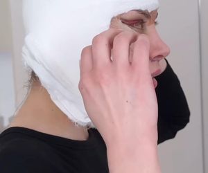 Julia Von Stein po operacji 