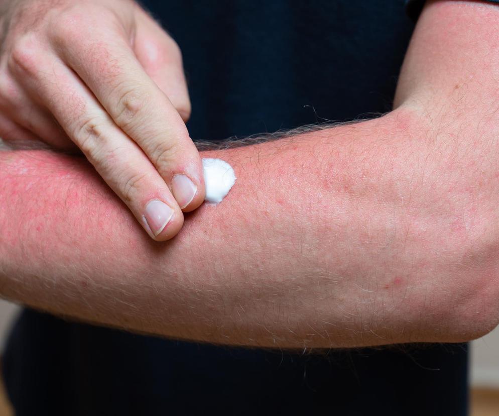 Stosowały ją nasze babcie, w PRL-u była hitem. Skąd się bierze jej moc?