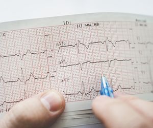 Arytmia serca - objawy, skutki, diagnoza, leczenie