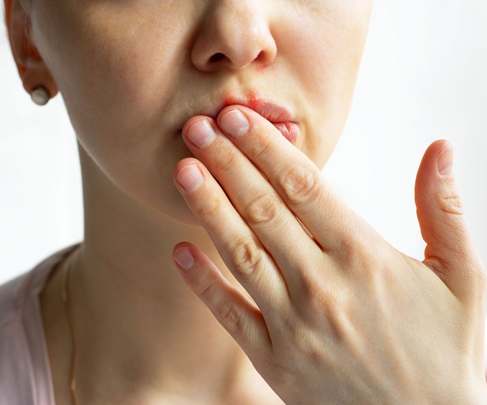 Bolesne objawy niedoboru witaminy B12. Można je dostrzec w jamie ustnej