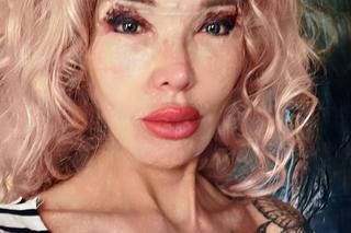 Ewa Minge wycięła powieki