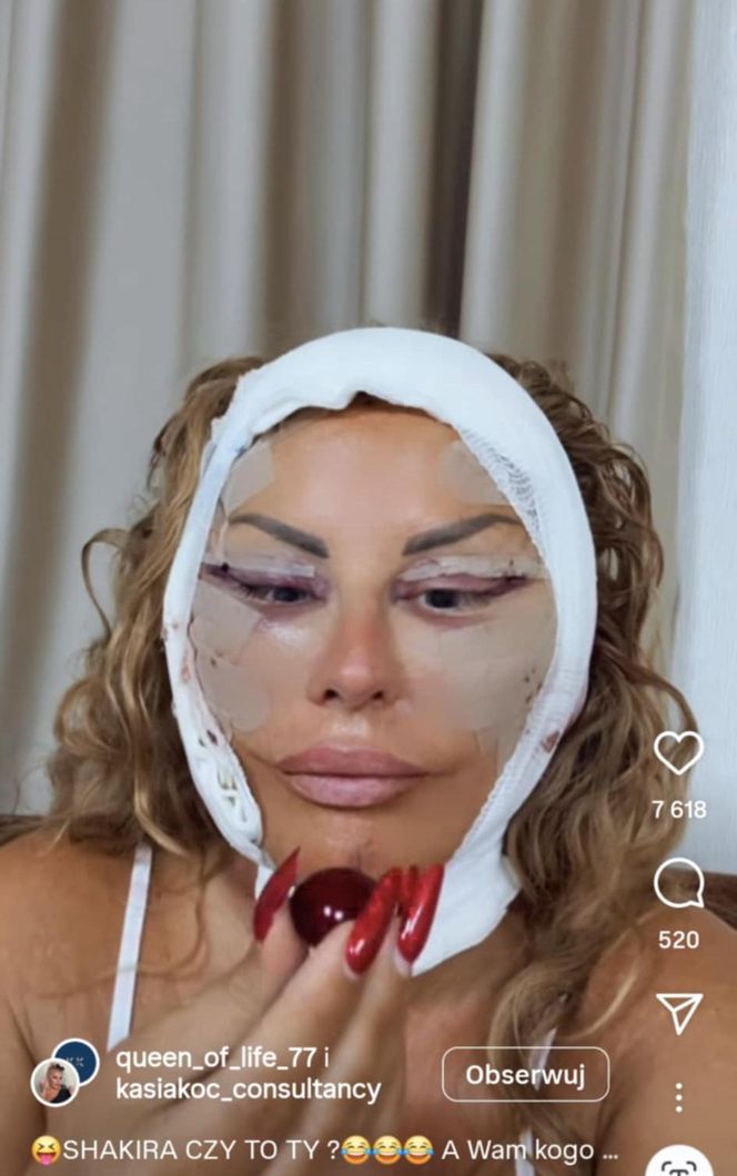 Dagmara Kaźmierska miała operację plastyczną