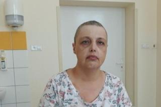  Anna z Leżajska ma nowotwór, WALCZY O ŻYCIE i błaga o pomoc.  Potrzeba 1,5 mln zł 