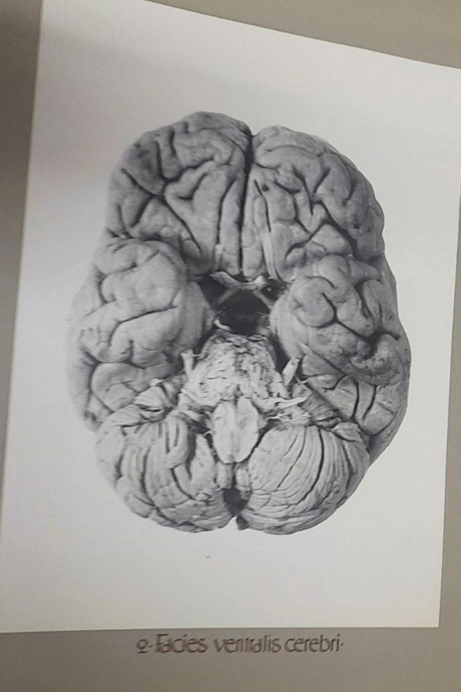 Tajemnica mózgu Piłsudskiego. Nieznany album w archiwach