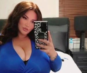 Piersi popularnej tiktokerki nie chcą przestać rosnąć. To wyjątkowo rzadka choroba