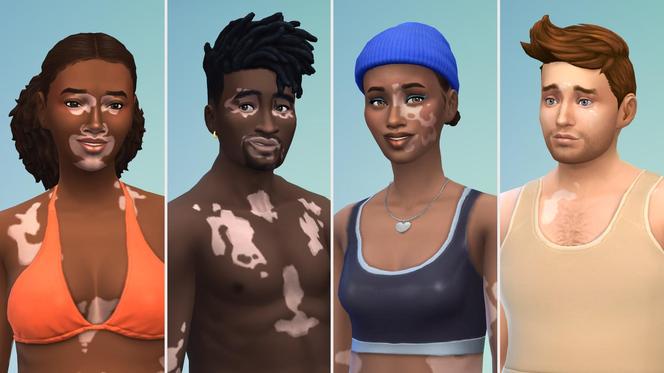 Bielactwo w The Sims 4 - zobacz, jak wyglądają simowie z nową cechą wyglądu