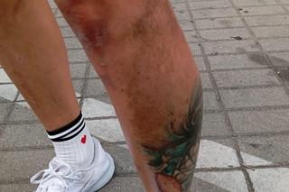 Zofia Klepacka: zostałam pobita