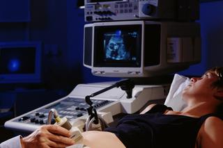 Czy trzecie badanie prenatalne jest konieczne? Ekspert wyjaśnia, dlaczego warto za nie zapłacić