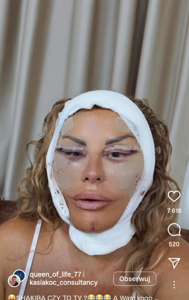 Dagmara Kaźmierska miała operację plastyczną