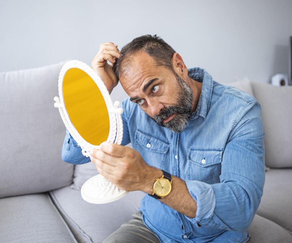 Martwisz się, że wyłysiejesz? Prawdę zdradzą twoje palce