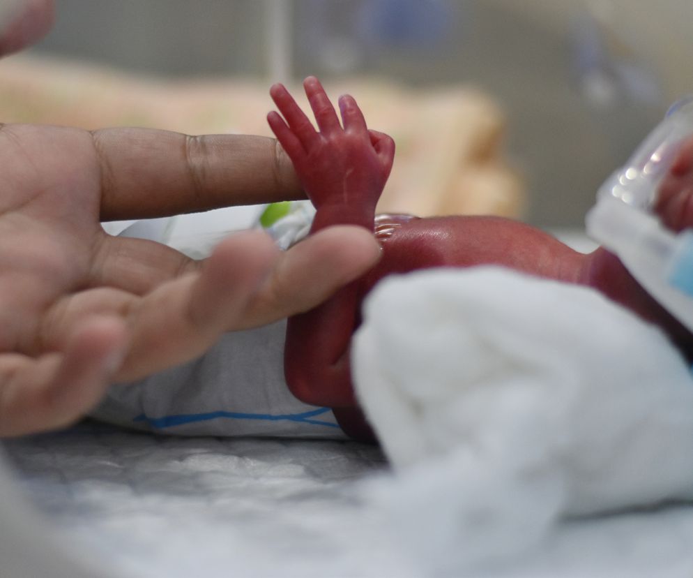 Po urodzeniu ważyła zaledwie 500 gramów. Lekarze dawali jej 30 proc. szans na przeżycie