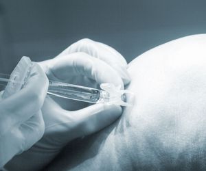 Punkcja stawu kolanowego: wskazania i przebieg