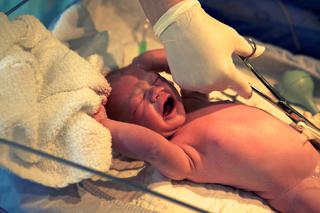 Fakty i mity o przecinaniu pępowiny u noworodka - to powinnaś wiedzieć