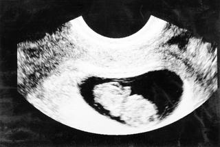 9 tydzień ciąży - USG