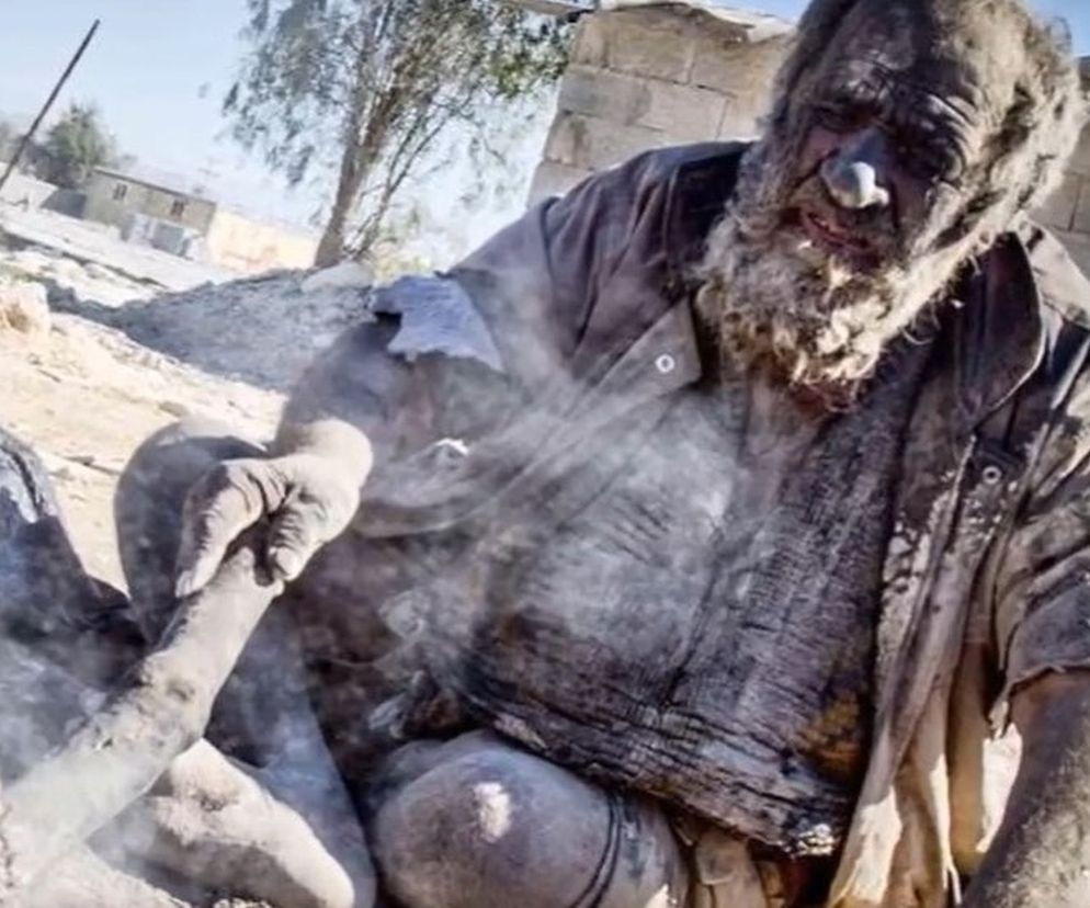 Zmarł Amou Haji - najbrudniejszy człowiek na świecie 