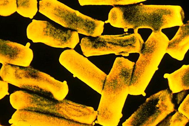 ZABÓJCZA BAKTERIA W SZPITALU