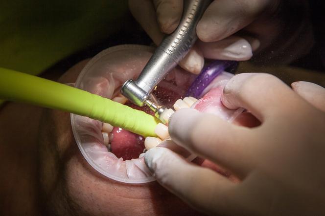 Lublin. Dentysta oskarżony o zmuszenie pacjentki do seksu oralnego. Nie była jedyną ofiarą?