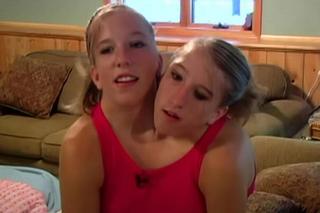 Bliźniaczki syjamskie wzięły ślub! Mają jedno ciało i dwie głowy, tylko jedna będzie żoną