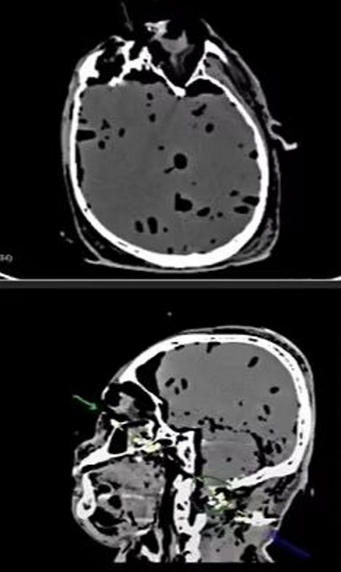 Ujawnił prawdę o sztucznej inteligencji. Znaleziono go martwego