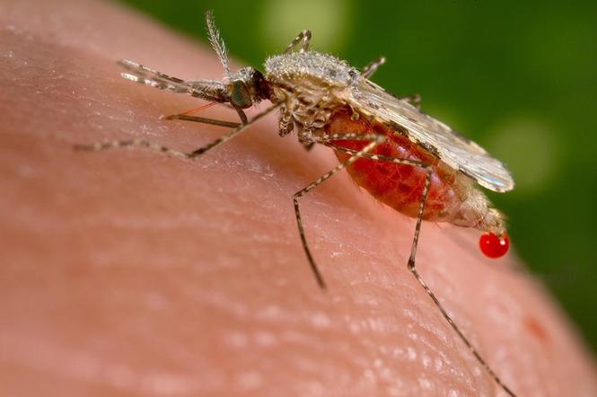 Jak załagodzić obrzęki po ukąszeniu komara?
