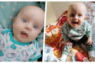 Mały Marcelek z Wyszogrodu walczy o powrót do normalności! Jego mama dowiedziała się o chorobie synka w dniu porodu [ZDJĘCIA]