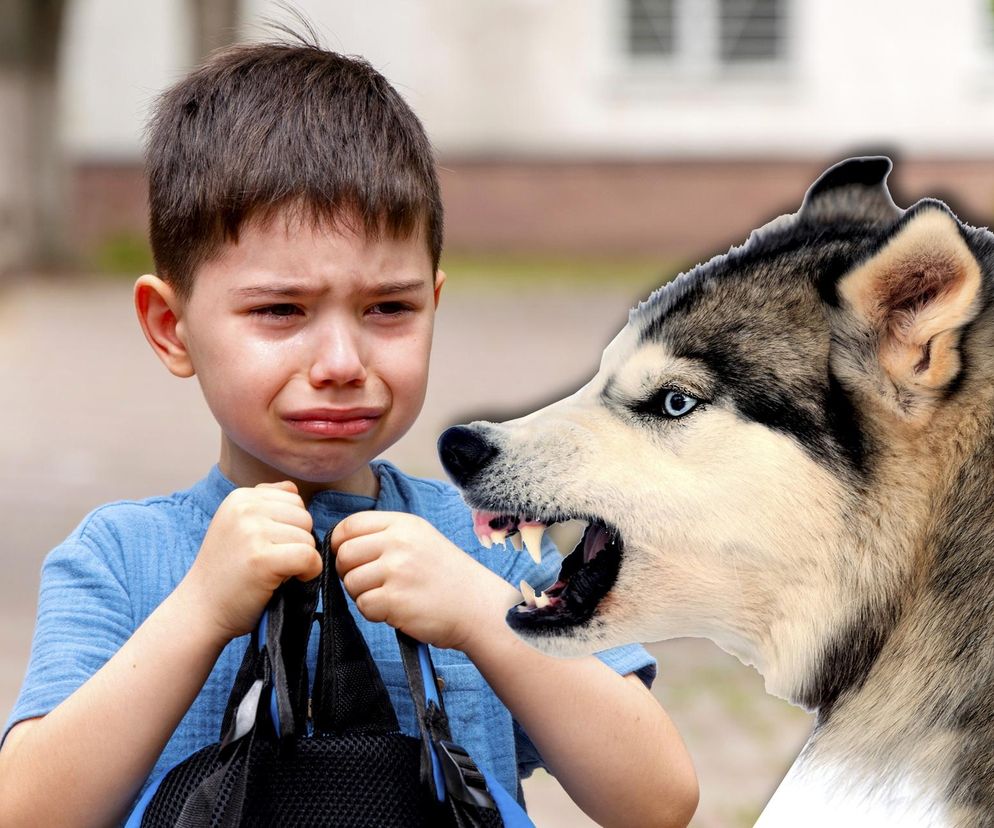 Atak psa na dziecko