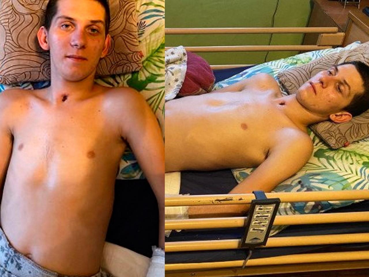 Łukasz wpadł pod ciągnik. To duża trauma. Rodzina błaga o pomoc