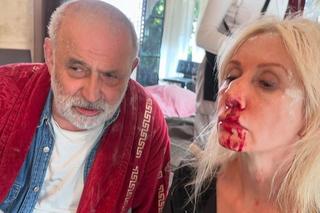 Ewa Gawryluk (Ewa z Pierwsza miłość)po wypadku na planie, Krzysztof Stelmaszyk