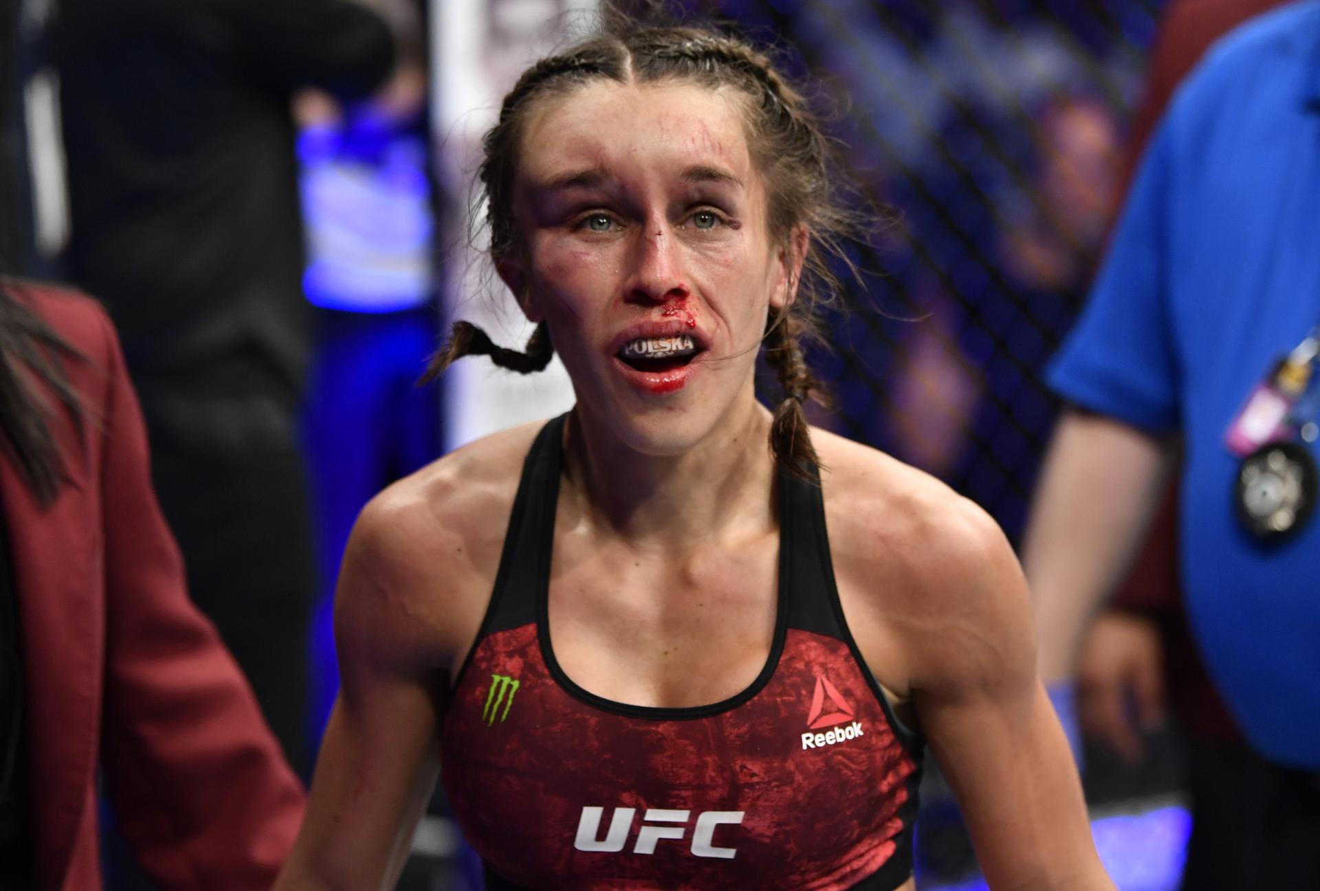 Joanna Jędrzejczyk pokazała twarz po walce. PĘKA jej głowa ...