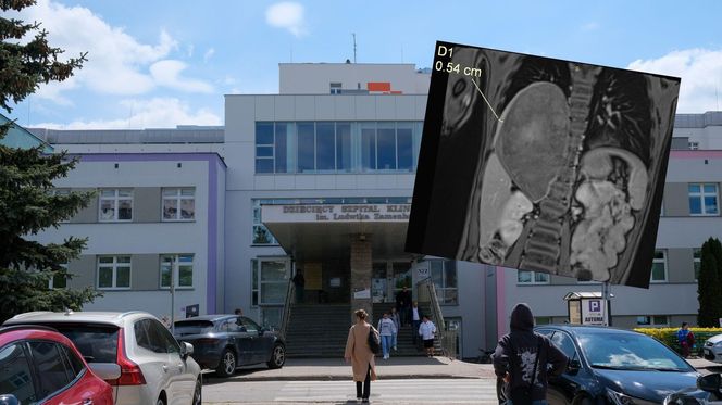 Wielki sukces lekarzy z Białegostoku! Usunęli gigantycznego guza z klatki piersiowej dziecka