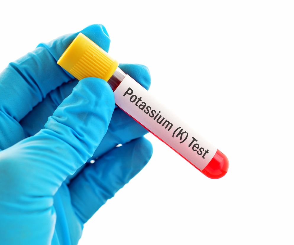 Hipokaliemia to zaburzenie elektrolitowe, w którym ilość jonów potasu w surowicy krwi wynosi poniżej 3,8 mmol/l.