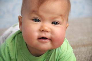 Nadwaga u niemowlaka - jak odchudzić dziecko i czy w ogóle to robić?