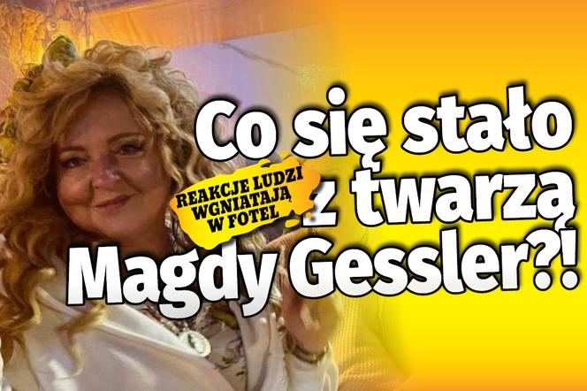 Co się stało z twarzą Magdy Gessler?!