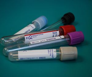 Kalisz. Ruszają bezpłatne i anonimowe badania w kierunku HIV