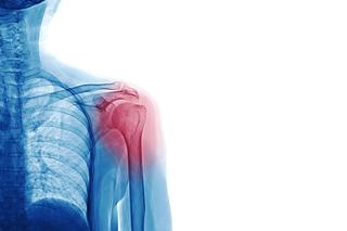 Staw ramienny - anatomia, funkcje i przyczyny bólu