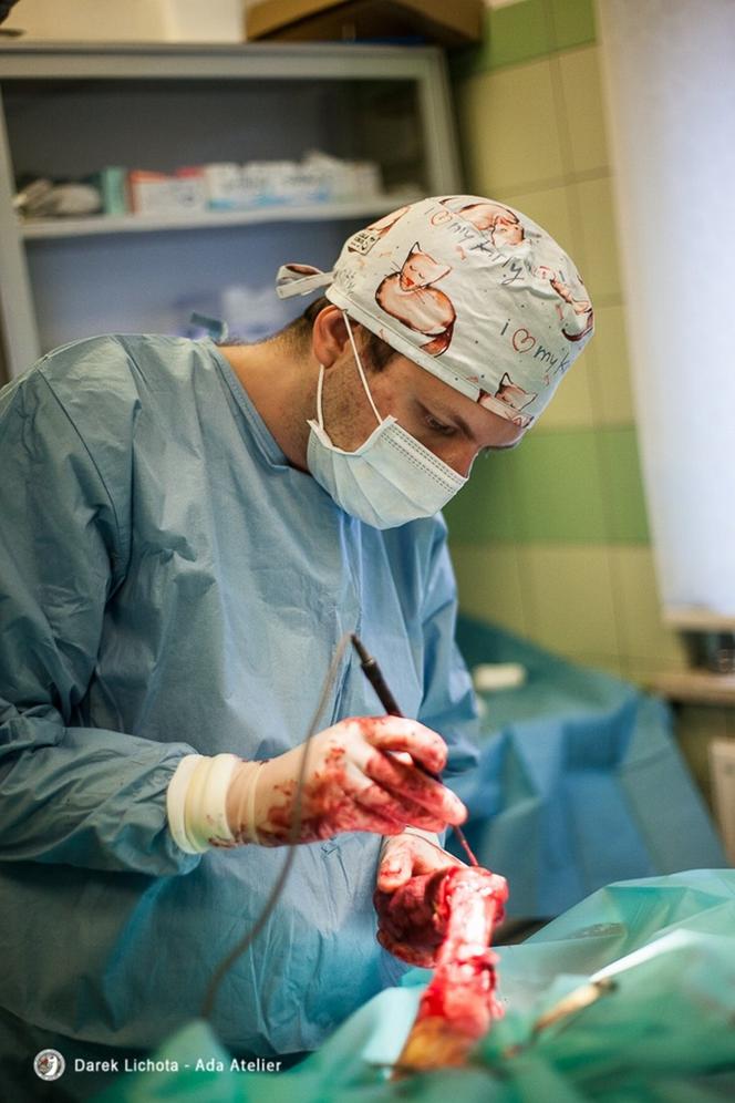 Dostał łapę z drukarki 3d