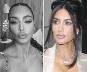 Zmarła sobowtórka Kim Kardashian. Była w trakcie kolejnego zabiegu