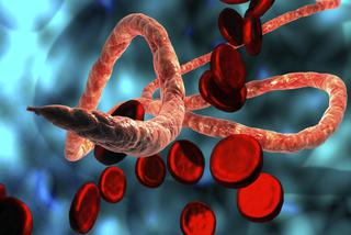 Gorączka krwotoczna ebola