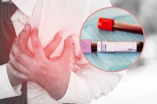 Grozi Ci zawał? Badanie krwi pomoże określić ryzyko