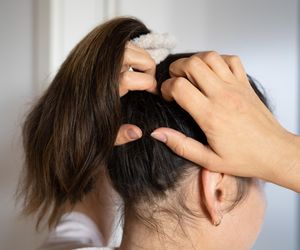 Swędzenie skóry głowy doprowadza mnie do „szału”. Jakie może być źródło tego problemu?