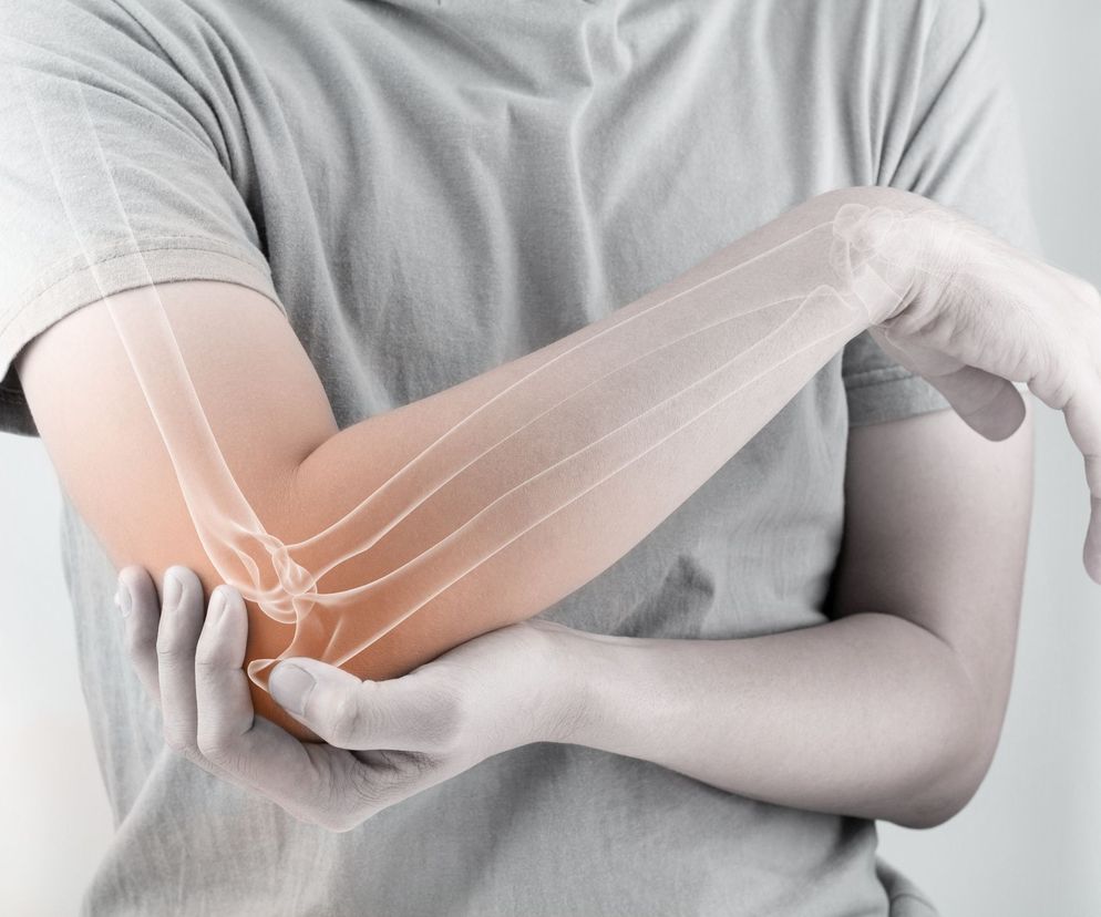 Artropatia – przyczyny, objawy, leczenie. Rodzaje artropatii