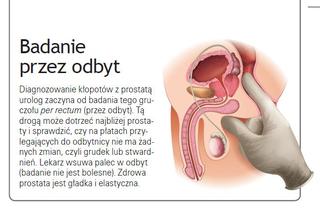 jak zmniejszyc powiekszona prostate